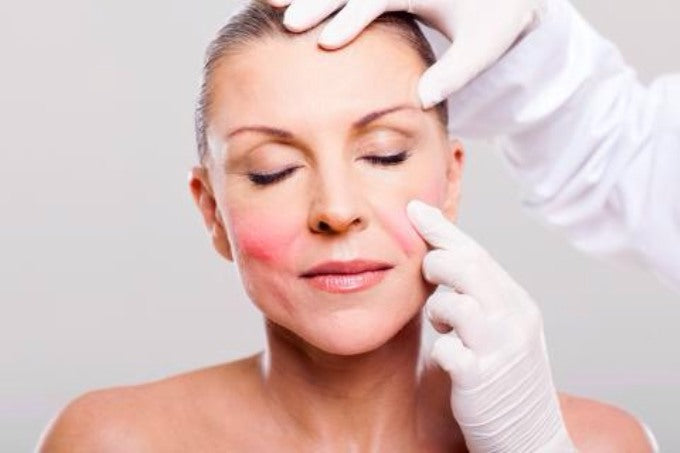 Soothing Guide To Skin Care for Rosacea and Sensitive Skin